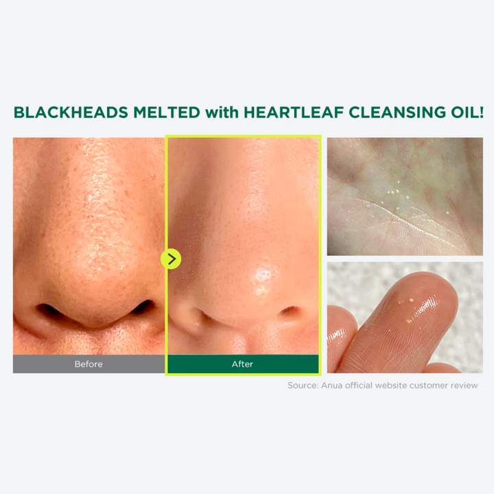 ANUA Heartleaf Pore Control Cleansing Oil Mini (20ml) results